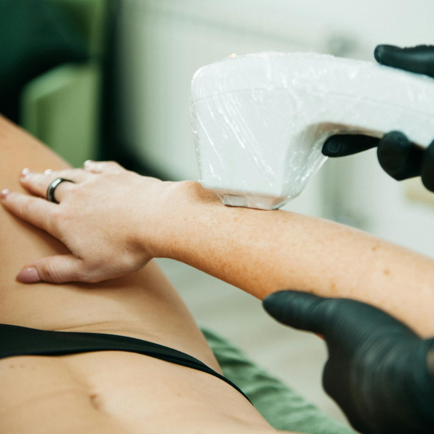 Depilación Láser Brazos Mujer