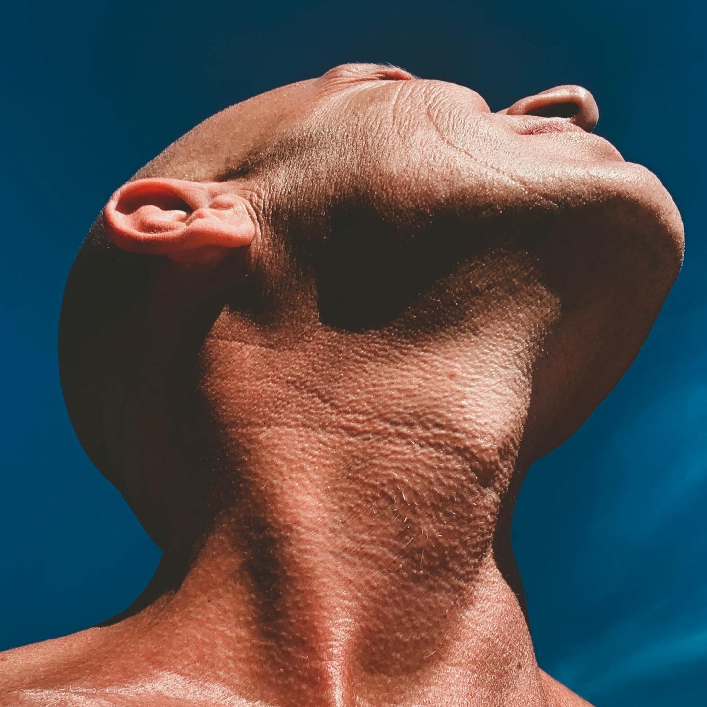 Depilación Láser Barba Hombre