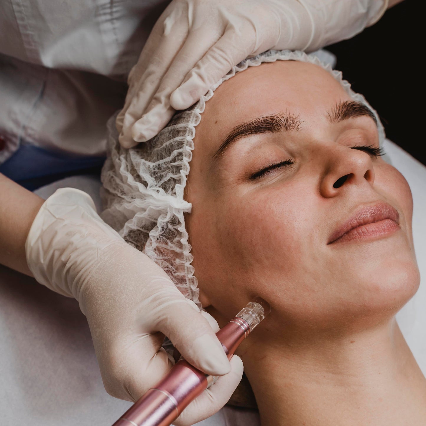 Rejuvenecimiento Facial + Plasma + Dermapen